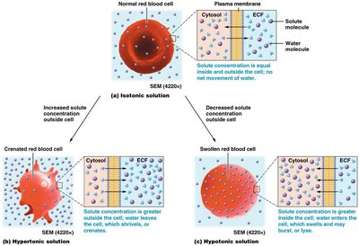 Hypertonic solution: cell shrinks