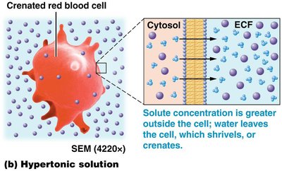 Hypotonic solution: cell swells