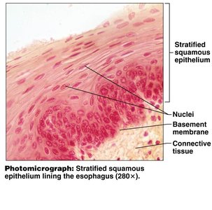 Photomicrograph of stratified squamous epithelium in esophagus