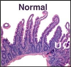 Normal villi with microvilli