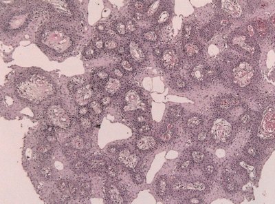Histology tissue slide