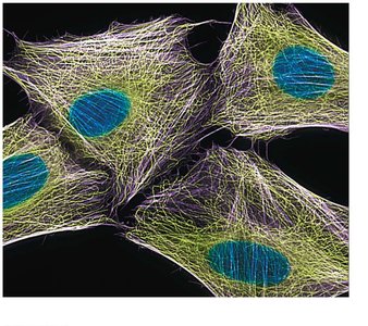 Microtubules in the cytoskeleton