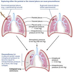 Atelectasis and pneumothorax mechanisms