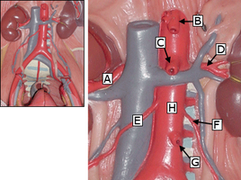 Close-up labeled diagram of abdominal aorta and branches