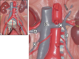 Labeled diagram of abdominal veins and arteries