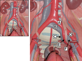 Labeled diagram of iliac arteries and veins