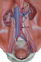 Diagram showing abdominal veins and arteries with clinical relevance