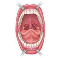 Anterior view of oral cavity