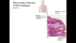 Esophagus-stomach junction