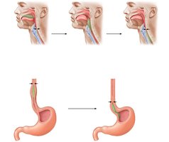 Swallowing and peristalsis