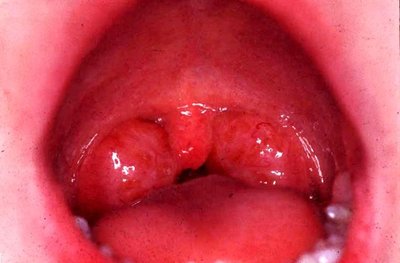 Spleen location and structure