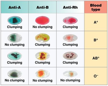 Blood typing test results
