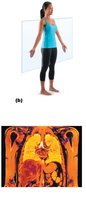 Frontal (coronal) plane and MRI scan