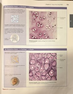 Hyaline and elastic cartilage micrographs
