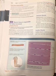 Skeletal muscle tissue micrograph