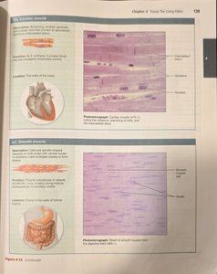 Cardiac muscle tissue micrograph