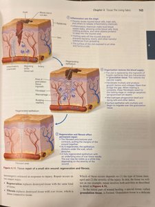 Tissue repair stages diagram