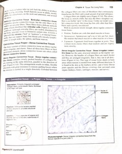 Dense irregular connective tissue micrograph