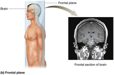 Frontal plane and section