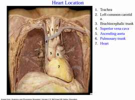 Heart location with major vessels and heart