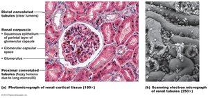 Detailed structure of the renal corpuscle and filtration membrane