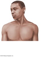 Cutaneous membrane (skin) covering the body surface