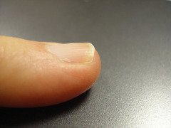 Close-up of a human fingernail showing nail body and lunula