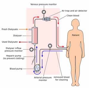 Dialysis model for drug clearance