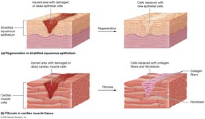 Tissue repair by fibrosis