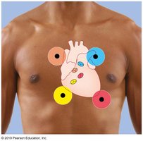 Labeling Activity: Pacemaker cells