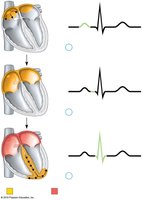 Labeling Activity: Heart sounds