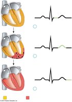 Labeling Activity: Wiggers diagram