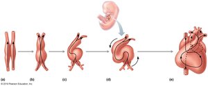 Labeling Activity: Cardiac Conduction