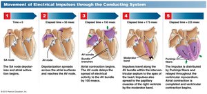 Labeling Activity: ECG