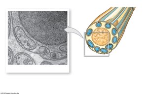 TEM of unmyelinated axons with Schwann cell