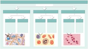 Classification of connective tissues