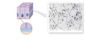 Diagram and micrograph showing epithelial attachment to basal lamina