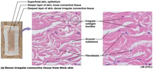 Dense irregular connective tissue from skin