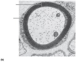 Cross-sectional view of a myelinated axon
