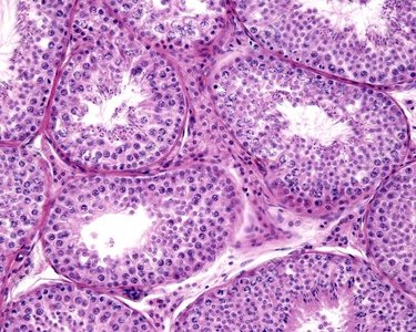 Histology of seminiferous tubules in testis