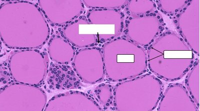 Histology of thyroid gland showing follicles and colloid