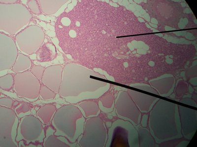 Histology of thyroid and parathyroid tissue