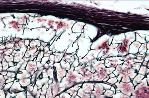 Reticular fibers forming a supportive network in tissue