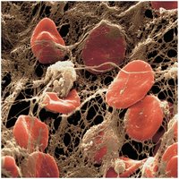Resting and activated platelets