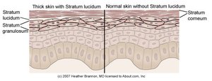 Comparison of thick and thin skin showing the presence or absence of the stratum lucidum