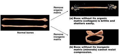 Osteoclasts on bone surface and bone resorption