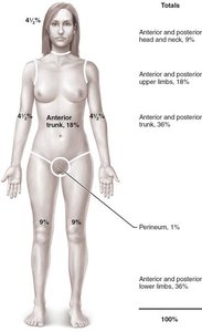 Rule of nines for burn assessment
