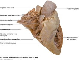 Anterior view of heart, pericardium removed
