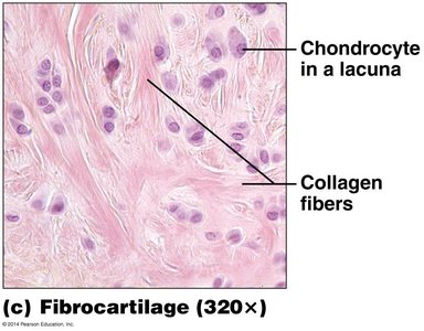 Photomicrograph of fibrocartilage showing chondrocytes and collagen fibers