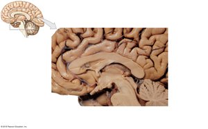 Midsagittal section showing the diencephalon and adjacent structures